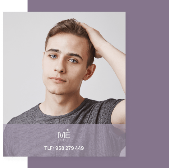 banner para alopecia de móvil