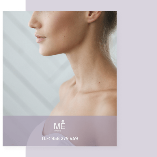 banner para cuello y escote de móvil