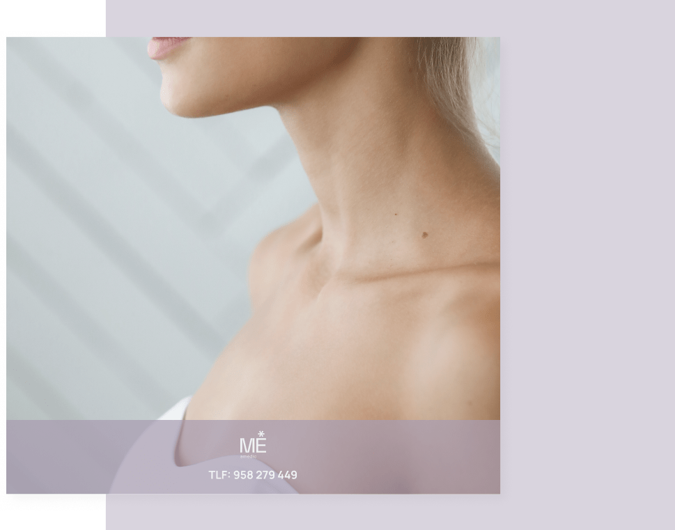 banner para cuello y escote de tablet