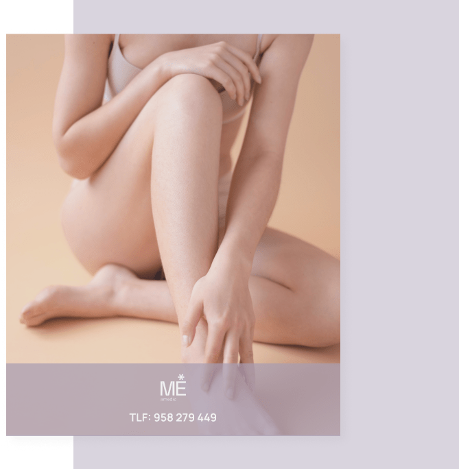 banner para estrías