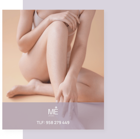 banner para estrías de móvil