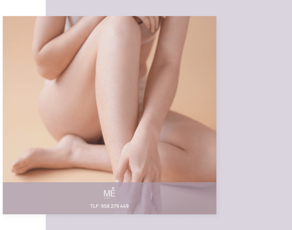 banner para estrías de tablet