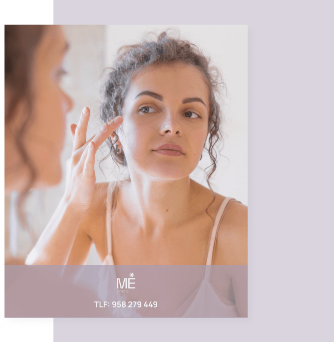 tratamiento de hilos tensores