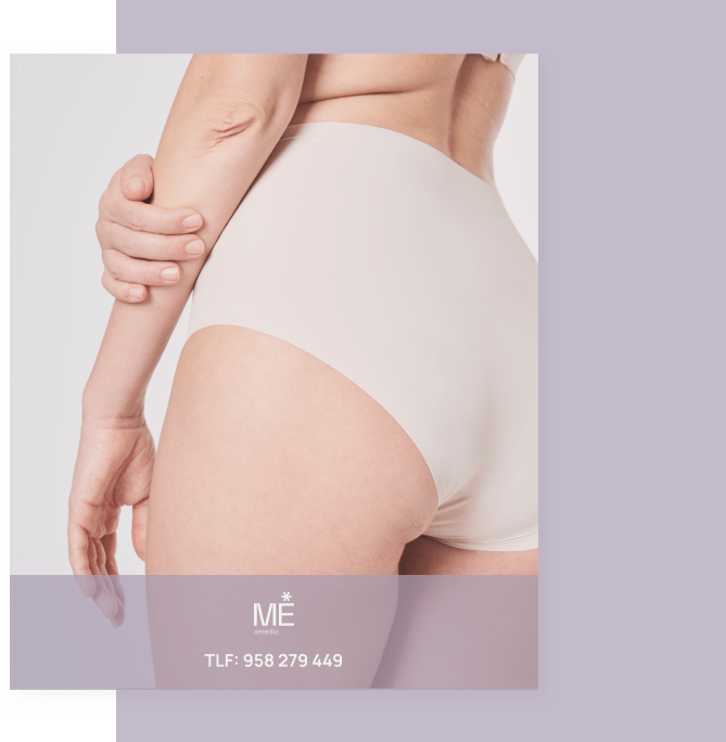 banner para hilos tensores