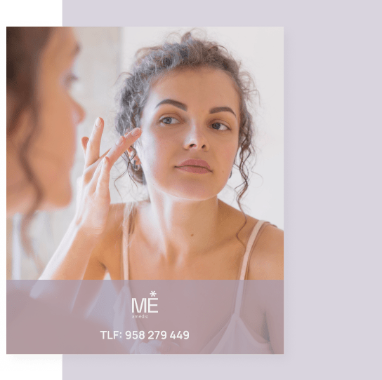 tratamientos de hilos tensores para móvil