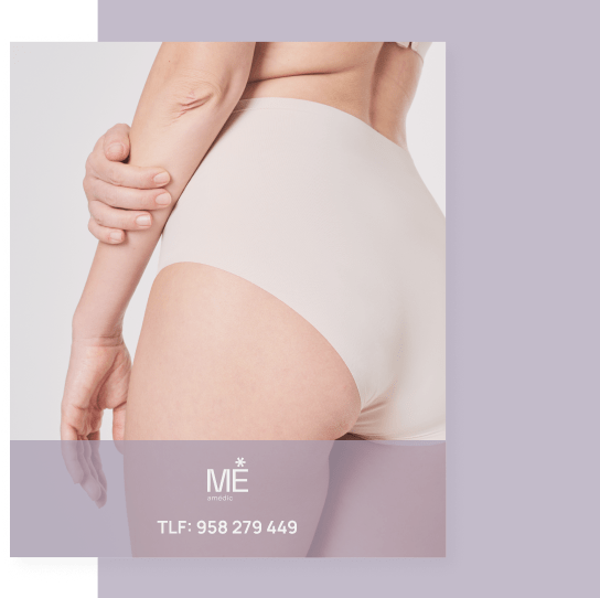 banner para hilos tensores de móvil