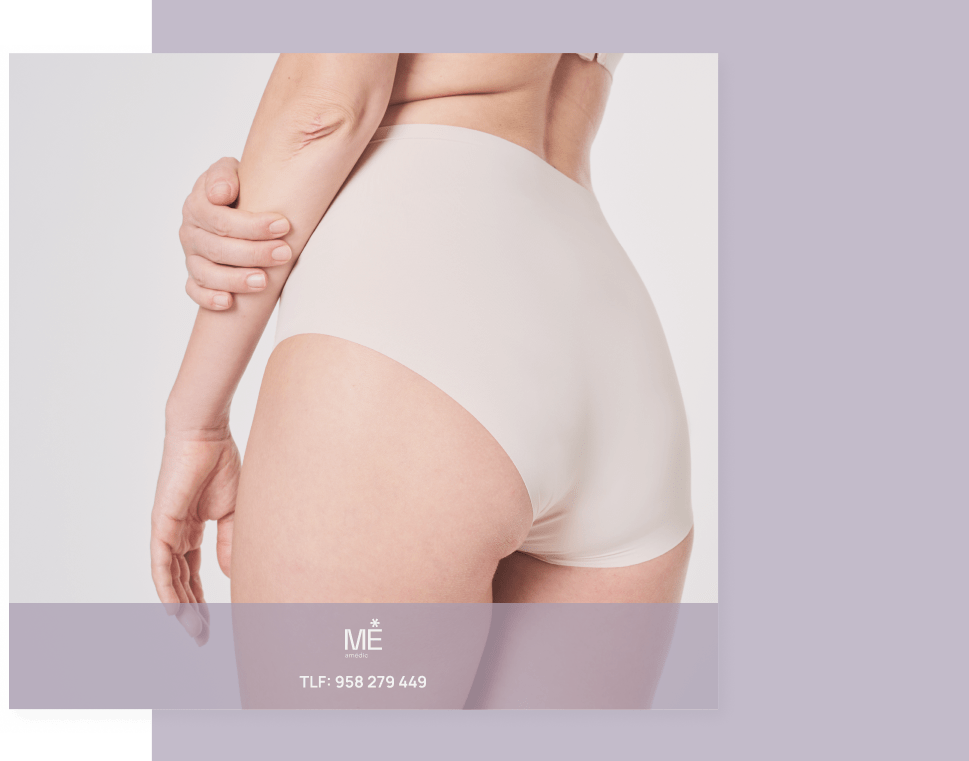 banner para hilos tensores de tablet