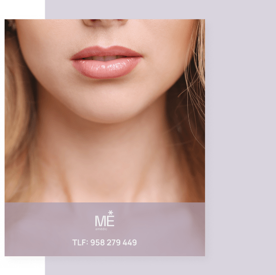 banner para labios de móvil