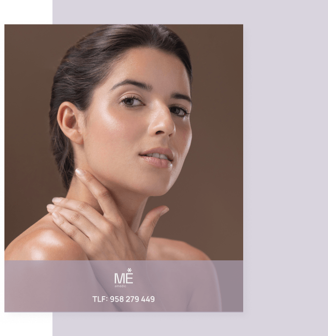 tratamiento de mesoterapia facial