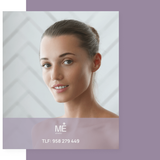 banner para óvalo facial de móvil