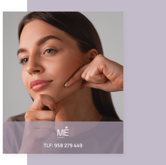 banner para pómulos de móvil