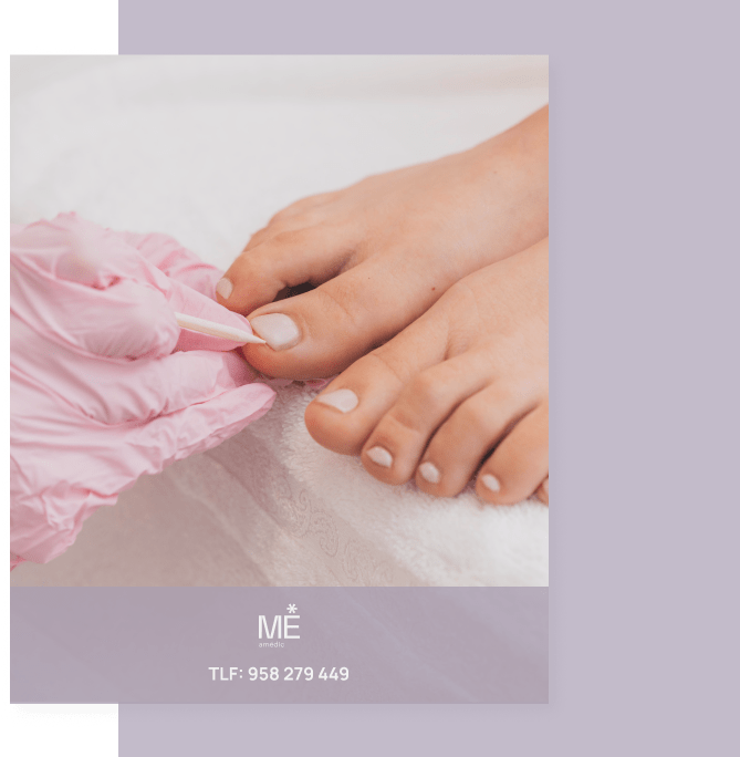 quiropodia-min quiropodia