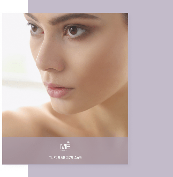 banner para rosácea