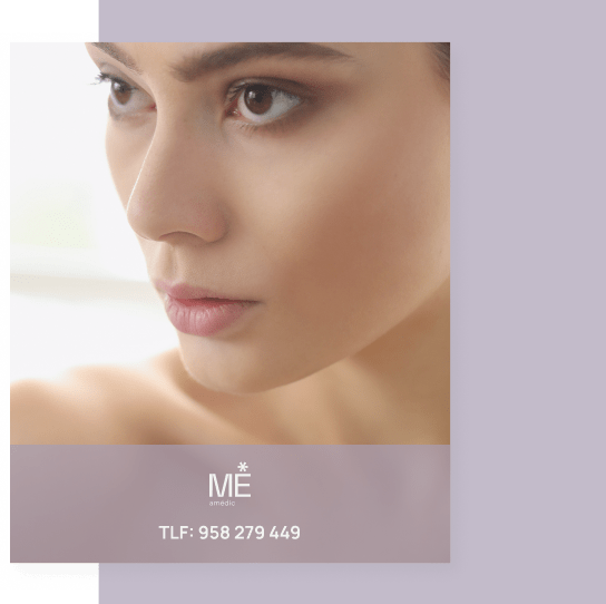 banner para rosácea de móvil