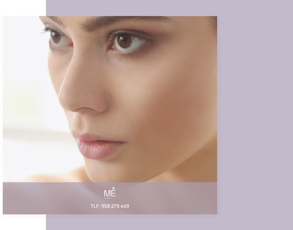 banner para rosácea de tablet