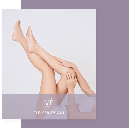 banner para varices de móvil
