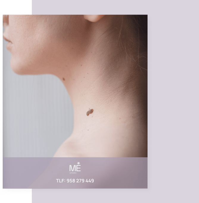 banner para verrugas