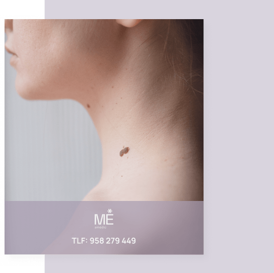 banner para verrugas de móvil