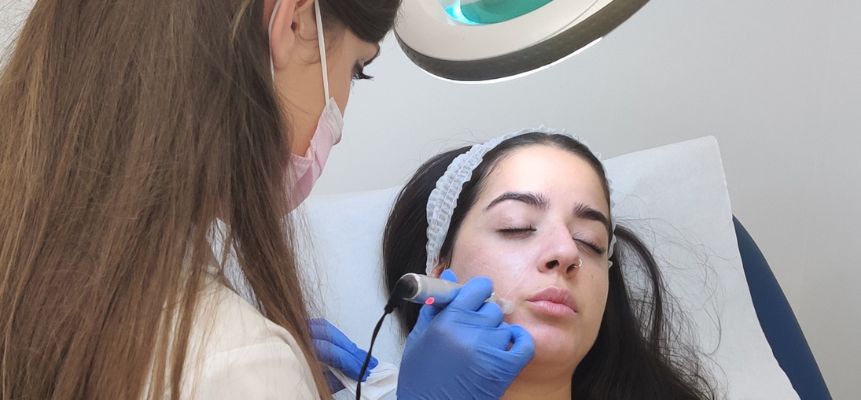 tratamiento para prevenir granos en la cara